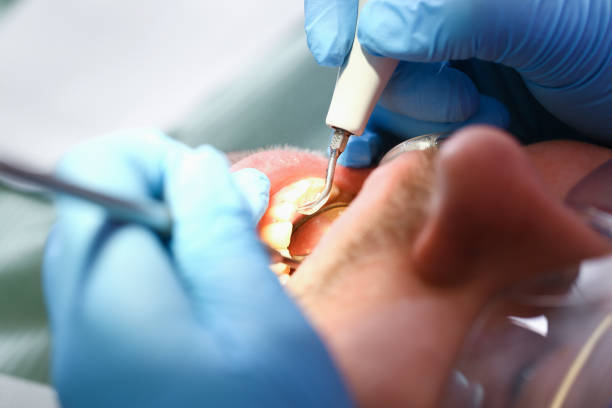Best Cracked Tooth Emergency Dentist  in University At Buffalo, NY