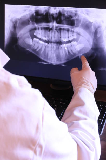 Best Urgent Tooth Repair  in University At Buffalo, NY