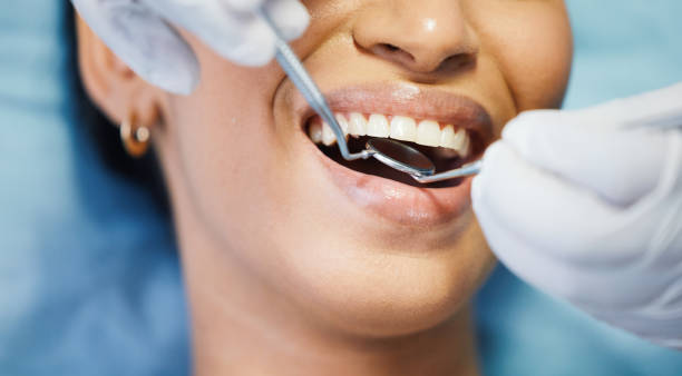 Best Broken Tooth Emergency  in University At Buffalo, NY