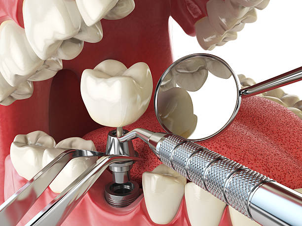 Best Emergency Gum Pain Relief  in University At Buffalo, NY